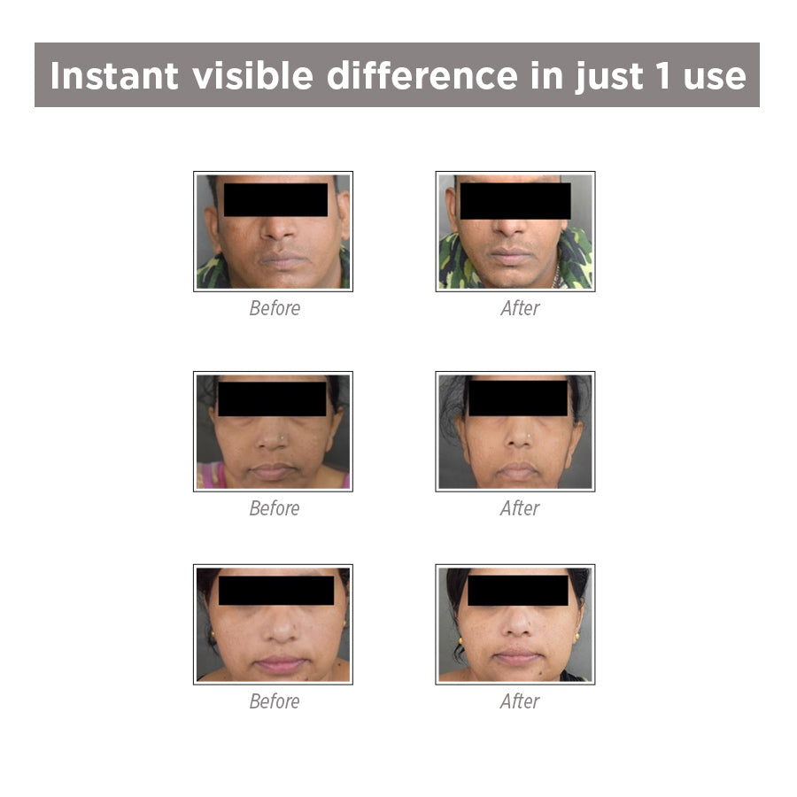 Detan+Glow Active Facial Kit - Anti Tan & Anti Pigmentation Facial Kit