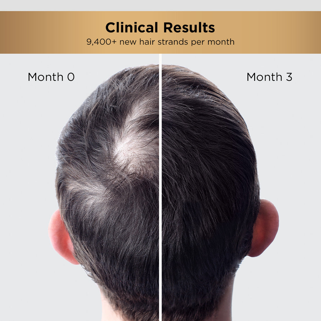 Hair Growth Serum | Visible Result in 3 Months